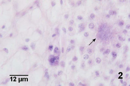 外套膜組織病理；Nocardia sp. (箭頭)被一群血林細胞圍在中央
<br>圖片參考來源：http://www.pac.dfo-mpo.gc.ca/sci/shelldis/images/nocaroy2.jpg
