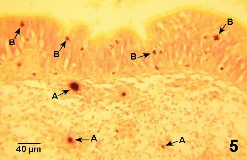 小腸組織病理；Nocardia sp.被許多血淋細胞(A)包圍，另外許多血淋細胞
(B)正沿著上皮細胞移動(Gram stain)。
<br>圖片參考來源：http://www.pac.dfo-mpo.gc.ca/sci/shelldis/images/nocaroy5.jpg