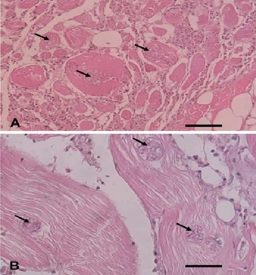 圖片參考來源：http://www.vetsci.org/2007/pdf/147.pdf
感染鰻魚肌肉橫切(A)及縱切(B)，顯示許多sporocyst及晶狀變性，伴隨淋巴球浸潤