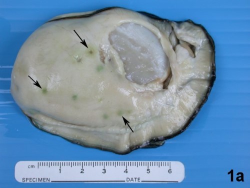 <i>Crassostrea gigas</i> 由殼移出於箭所指可明顯看出 <i>Mikrocytos mackini</i> 充滿於 vesicular connective tissue cells 肉眼上呈現徑約5mm 大小之黃綠色(yellow green)膿皰(pustules)。(Bower 2007)