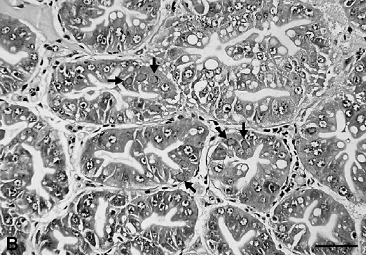圖片參考來源：Hwieh 2006 報告中在tubular epithelial cells of 圖二：the hepatopancreas.中亦可見到Cowdey type B 之嗜酸性核內胞函體。