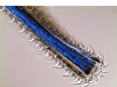 <i>Rhadinorhynchus</i>圖片參考來源：
http://www.fishdisease.net/fd/disease_images/image.php?img_id=472