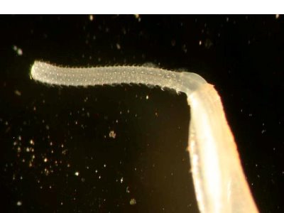 <i>Rhadinorhynchus</i>圖片參考來源：
http://www.fishdisease.net/fd/disease_images/image.php?img_id=453