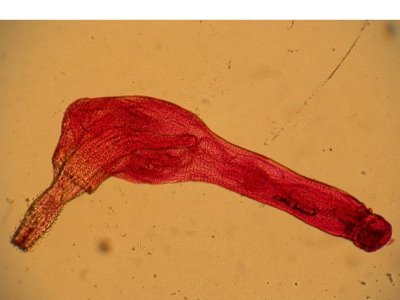 A photomicrograph of the <u>acanthocephalan</u> <i>Corynosoma wegeneri</i>. Taken by Dr Neil Campbell, University of Aberdeen, Scotland, UK.