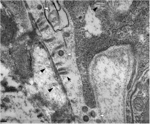 Fig1草蝦(<i>Penaeus monodon</i>).電子顯微鏡下可見spherical to ovoid (約85 to 100 nm diameter) MoV virions (white arrowheads) 及GAV nucleocapsids (black arrowheads) COWLEY 2005