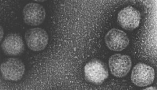 IPNV 病毒顆粒其大小約60 nm 屬於20面體( Einar Everitt) 圖片參考來源：http://www.cob.lu.se/virology/proj_descr.html