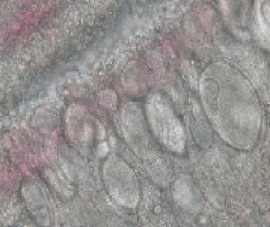 圖1：鰓濕壓片於光學顯微鏡下可見平滑均質之包函體(smooth homogeneous inclusion) (版權為趙嘉本所有，本所已取得使用版權)。