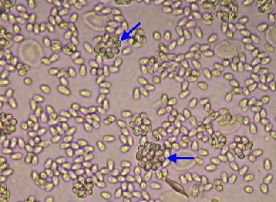 石斑魚感染微孢子蟲中可將腹腔中之異物瘤(xenoma) 作壓片可見到單一游離之孢子(spores)及sporophorous vesicle中之spore(箭) (版權為趙嘉本所有，本所已取得使用版權)
