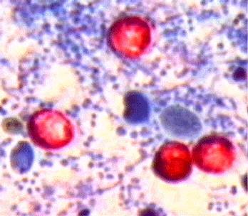 Oocysts of Cryptosporidium parvum stained by the acid-fast method. ( Avianbiotech.com )