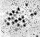 在EPC細胞株之細胞質內六角型蛙虹彩病毒顆粒(約128nm)圖片來源：AAHRI Newsletter Article，7(2)，1998.